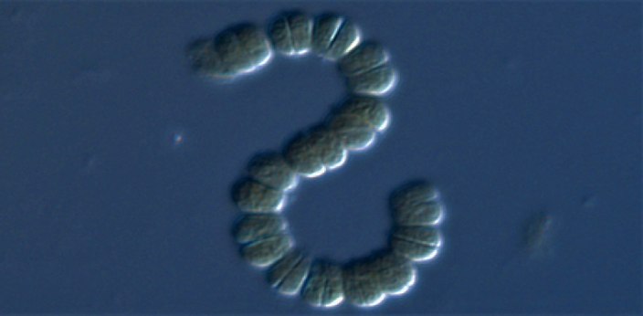 Microscope view of Actinomycete sp.