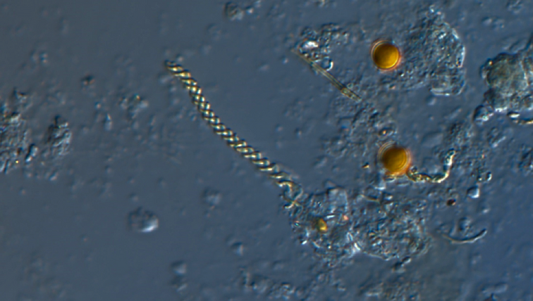 Microscope view of iron bacteria from slide 1.