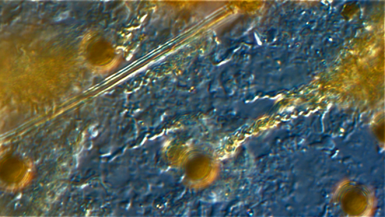 Microscope view of iron bacteria from slide 2.